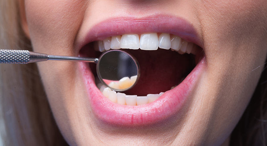 How Cosmetic Dentistry Can Improve More Than Just Your Smile